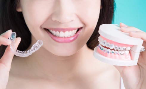 Invisalign Benefits, 100 Mile House Dentist